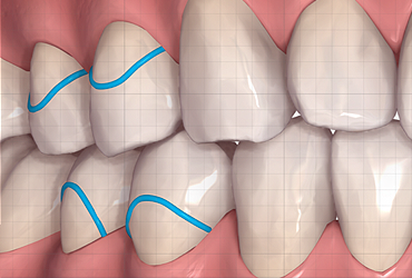 CLINCHECK CLINICAL ADVICE